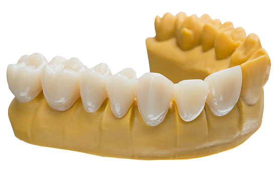 RESINA DE IMPRESSÃO 3D - VARSEO SMILETEMP BEGO