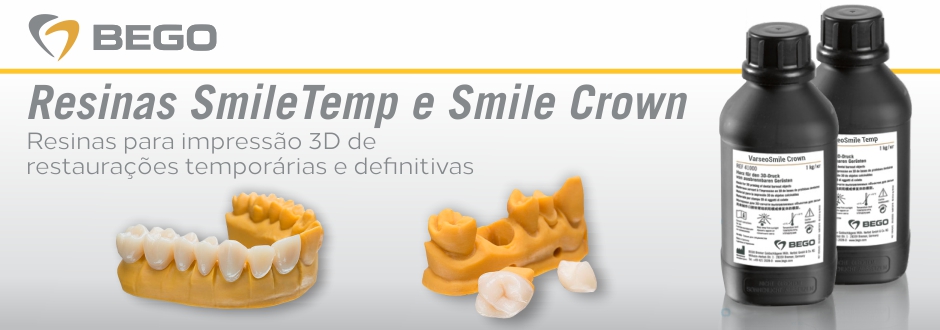 Smile Temp e Smile Crown